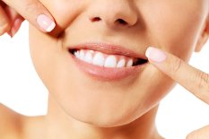 Zahn Power Bleaching beim Zahnarzt - Zähne Bleichen - white smile