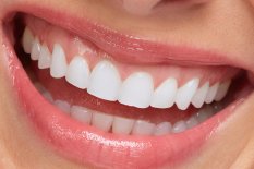 Zahnarztpraxis Dr. Kessler Wollerau: Masslösungen für zerstörte oder fehlende Zähne bei nahezu jedem Befund – Kronen, Brücken, Prothesen oder auch eine Kombination davon