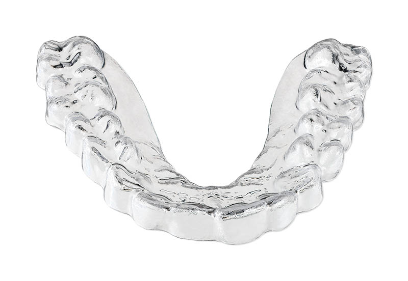 Bei Zähneknirschen kann eine Knirscherschiene für den Ober- oder Unterkiefer individuell angefertigt werden, die vor Zahnabrieb schützt und das gesamte Kausystem entlastet