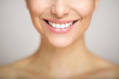Zahnästhetik in der Praxis Kessler: Korrektur verfärbter, unschön geformter Zähne und Zahnfehlstellungen mit Veneers (Keramikverblendschalen), Bleaching, Kunststoffaufbauten